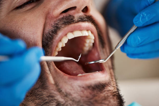 Best Emergency Broken Tooth Repair in Clay, CA