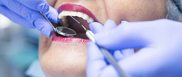 Best Urgent Dental Care in Clay, CA