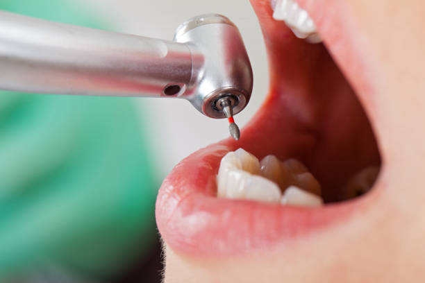 Best Pediatric Emergency Dentist in Clay, CA